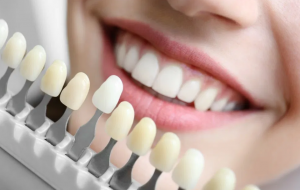 Dental Color, Everything We Need To Know And Its Relationship With Dental Aesthetics