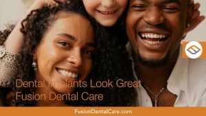 fusion fb dental implants 03.00 00 06 04.still022