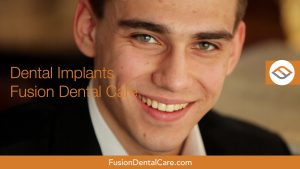 fusion fb dental implants 09.00 00 03 07.still024