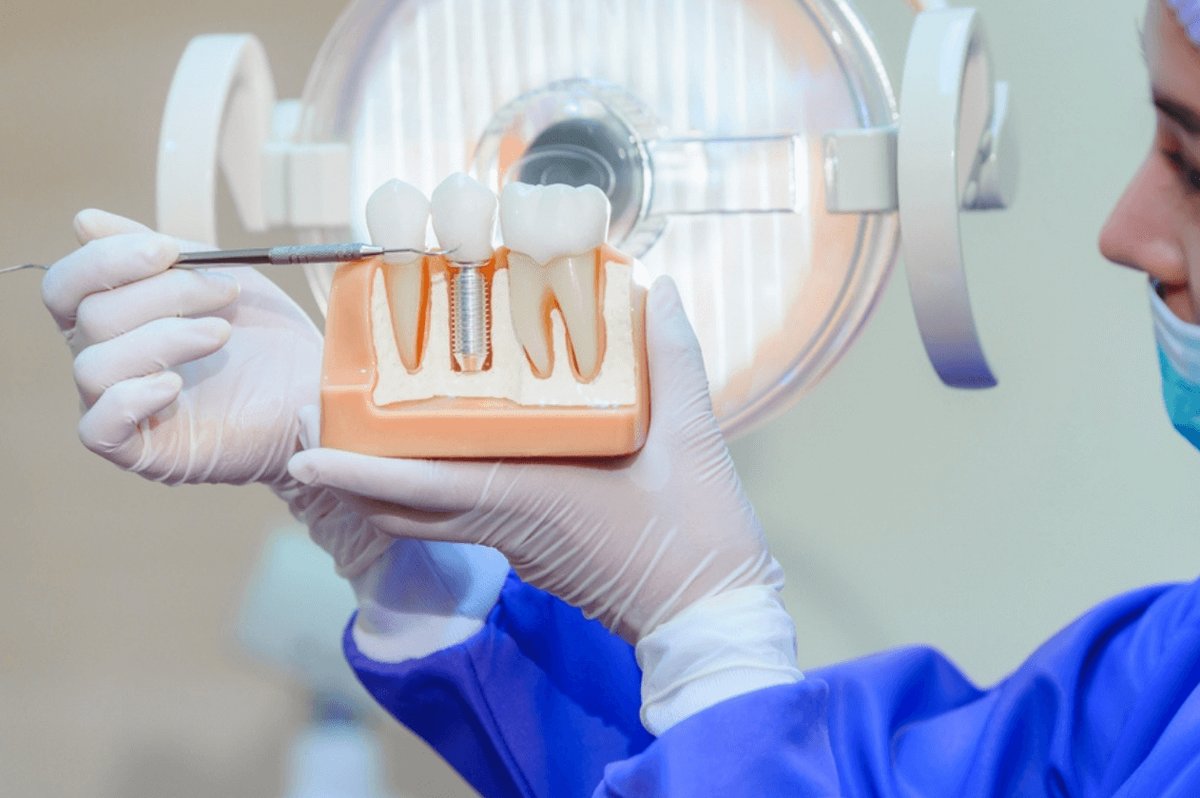 Dentist at Fusion Dental Care in Raleigh holding a dental implant model